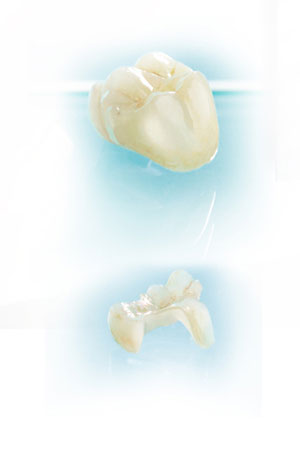 CEREC Dental Crowns @ Dean Cosmetic Dentistry